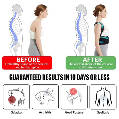 Posture Corrector Belt Unisex,Free Size Posture Corrector For Men And Women